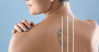 Complete Guide: How To Remove A Tattoo Safely & Effectively